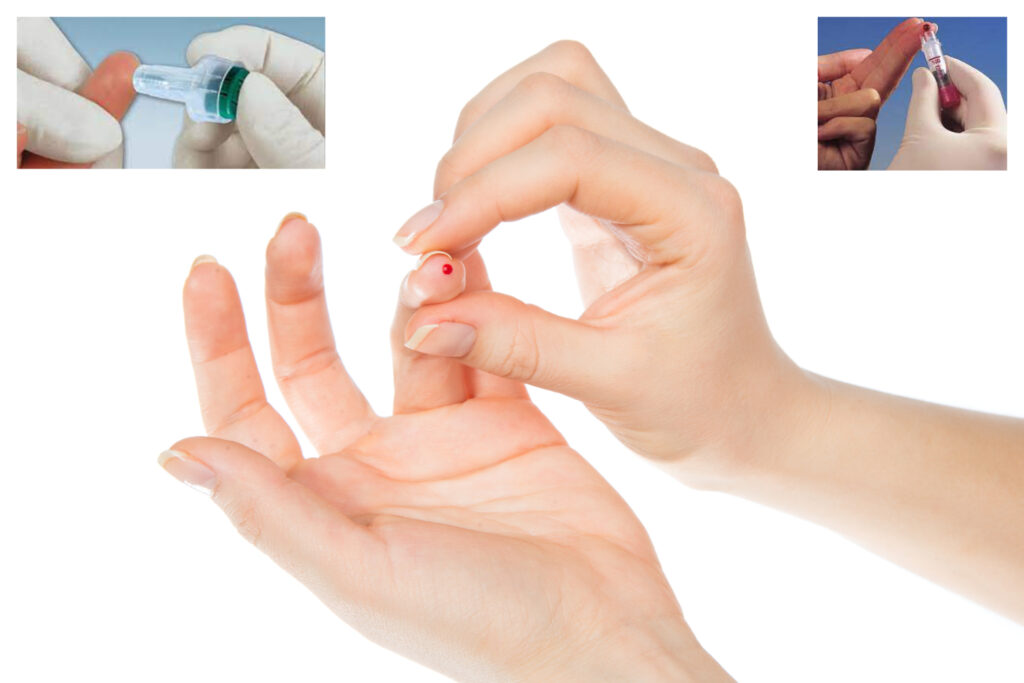 capillarybloodtaking_1