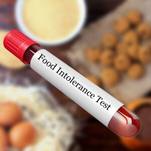 blood-sample-in-test-tube-for-food-intolerance-test-in-laboratory-1178653617_3508x2480_2